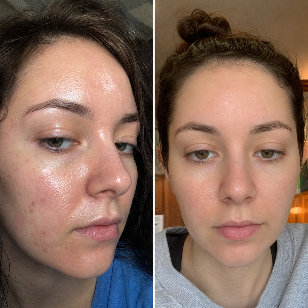 Серум за лице PURE AM - three drops before after