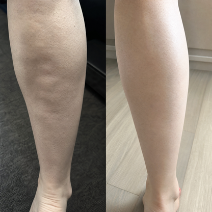 ПРОМО Комплект антицелулит + тен = Summer Body