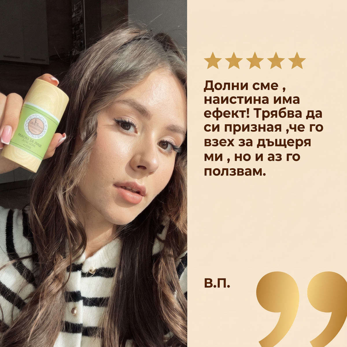 ПРОМО комплект срещу косопад Shiny