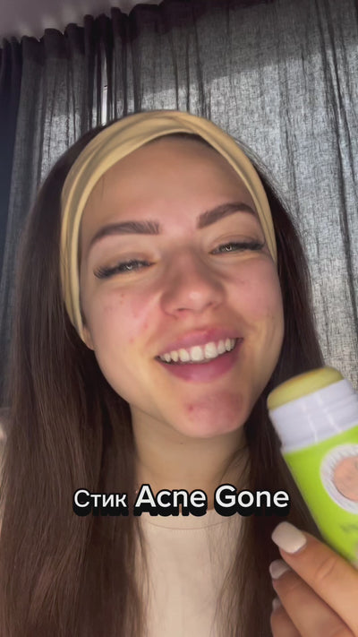 ПРОМО Комплект при акне ACNE GONE - клиентска снимка