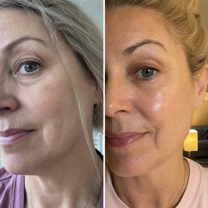 Серум за лице RENEW - three drops before after
